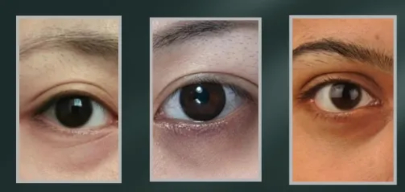dark circle color